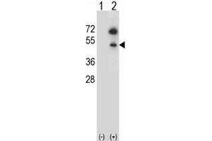 Western blot analysis of GNAS (arrow) using GNAS Antibody (C-term) Cat. (GNAS antibody  (C-Term))