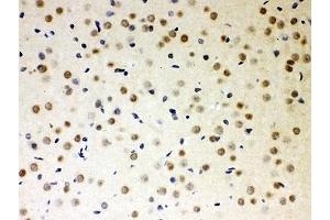 IHC-P: PKC iota antibody testing of rat brain tissue (PKC iota antibody  (AA 21-214))