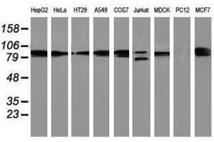 Image no. 2 for anti-Protein Kinase C, epsilon (PRKCE) antibody (ABIN1500232) (PKC epsilon antibody)