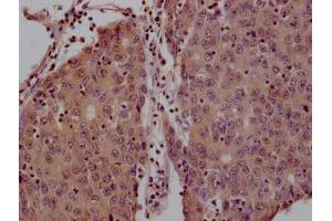 Immunohistochemistry (IHC) image for anti-14-3-3 zeta (YWHAZ) (AA 133-212) antibody (ABIN7142109)