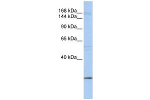 UBR2 antibody used at 1 ug/ml to detect target protein. (UBR2 antibody  (C-Term))