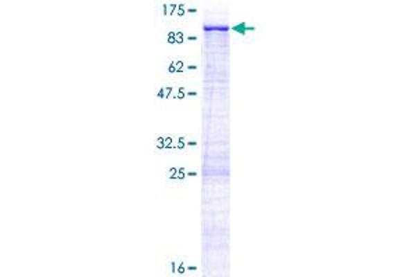 ZNF182 Protein (AA 1-620) (GST tag)