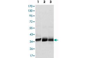 Western blot analysis using MSI2 monoclonal antibody, clone 2C11  against NTERA-2 (1), SW620 (2) and T-47D (3) cell lysate. (MSI2 antibody)