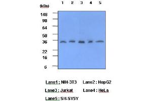 Western Blotting (WB) image for anti-C-Reactive Protein (CRP) (AA 19-224) antibody (ABIN317506) (CRP antibody  (AA 19-224))