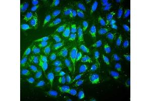 IF analysis of ALDH2 using anti-ALDH2 antibody (ABIN7603122).