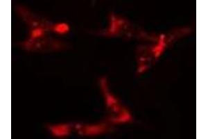 ABIN6275900 staining  HuvEc cells by IF/ICC. (TOLLIP antibody  (Internal Region))