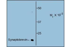 Western Blotting (WB) image for anti-Vesicle-Associated Membrane Protein 1 (Synaptobrevin 1) (VAMP1) antibody (ABIN782443) (VAMP1 antibody)