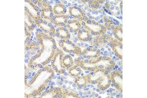 Immunohistochemistry of paraffin-embedded rat kidney using DAP antibody (ABIN6130322, ABIN6139397, ABIN6139398 and ABIN6221757) at dilution of 1:200 (40x lens).