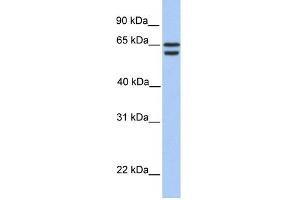 WB Suggested Anti-CDYL2 Antibody Titration:  0. (CDYL2 antibody  (N-Term))