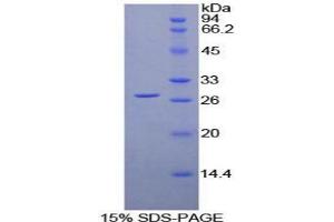SDS-PAGE analysis of Human LILRA2 Protein.