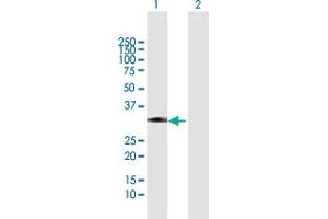 Western Blot analysis of ZCRB1 expression in transfected 293T cell line by ZCRB1 MaxPab polyclonal antibody. (ZCRB1 antibody  (AA 1-217))