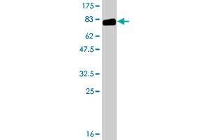 Western Blotting (WB) image for anti-Serpin Peptidase Inhibitor, Clade G (C1 Inhibitor), Member 1 (SERPING1) (AA 1-500) antibody (ABIN560115)