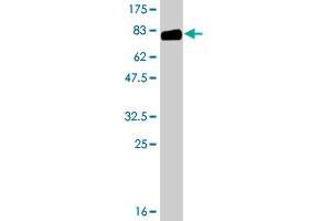 Western Blot detection against Immunogen (81. (SERPING1 antibody  (AA 1-500))