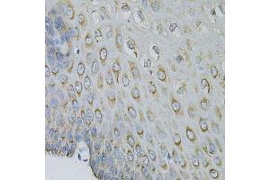 Immunohistochemistry of paraffin-embedded human esophagus using EIF4B Antibody. (EIF4B antibody)