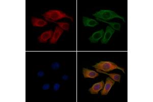 ABIN6262495 and ABIN6277945 staining Hela cells by IF/ICC.