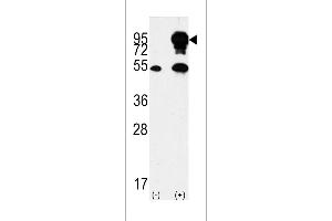 Western blot analysis of BRAF Antibody (Center) polyclonal antibody (ABIN392246 and ABIN2841936) (arrow). (SNRPE antibody  (AA 424-453))