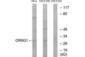 Western blot analysis of extracts from HeLa/COLO cells, using OR9G1 Antibody.