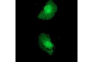 Anti-FKBPL mouse monoclonal antibody (ABIN2453045) immunofluorescent staining of COS7 cells transiently transfected by pCMV6-ENTRY FKBPL (RC202153). (FKBPL antibody)