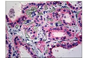 Human Thyroid: Formalin-Fixed, Paraffin-Embedded (FFPE) (CD51 antibody  (C-Term))