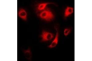 Immunofluorescent analysis of CD27 staining in MCF7 cells. (CD27 antibody)