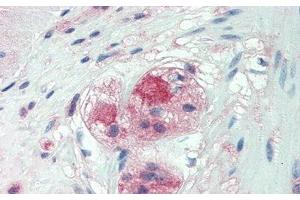 Detection of CSPG4 in Human Small Intestine Tissue using Monoclonal Antibody to Chondroitin Sulfate Proteoglycan 4 (CSPG4) (NG2 antibody  (AA 559-776))