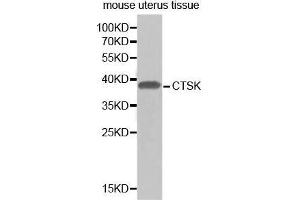 Western Blotting (WB) image for anti-Cathepsin K (CTSK) (AA 115-329) antibody (ABIN3022539) (Cathepsin K antibody  (AA 115-329))