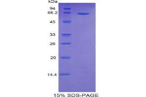 SDS-PAGE analysis of Human Sulfatase 2 Protein. (SULF2 Protein)