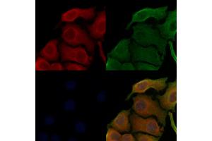 ABIN6258695 and ABIN6273499 staining Hela cells by IF/ICC.