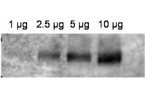 Western blot using  affinity purified anti-ABCB1 antibody shows detection of ABCB1 in crude membrane extracts from HF insect cells over-expressing human ABCB1. (ABCB1 antibody  (Internal Region))