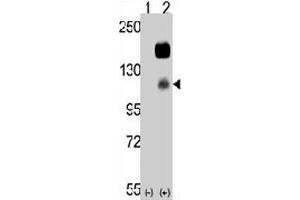 Western blot analysis of CCK4 (arrow) using rabbit PTK7 polyclonal antibody . (PTK7 antibody  (N-Term))