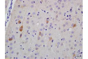 Formalin-fixed and paraffin embedded rat brain labeled with Anti-NF-H Polyclonal Antibody, Unconjugated  at 1:200 followed by conjugation to the secondary antibody and DAB staining (NEFH antibody  (AA 21-120))