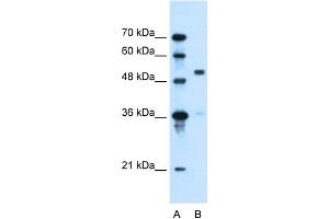 WB Suggested Anti-SLC37A3 Antibody Titration:  0.