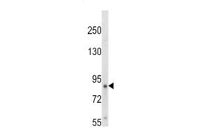 Western blot analysis of hTrkA-p (ABIN652381 and ABIN2841827) in HepG2 cell line lysates (35 μg/lane).