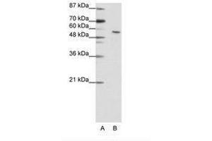 Image no. 1 for anti-Insulinoma-Associated 2 (INSM2) (N-Term) antibody (ABIN202769) (INSM2 antibody  (N-Term))