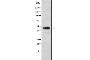 Western blot analysis of CCBE1 using HUVEC whole cell lysates (CCBE1 antibody  (Internal Region))