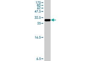 Western Blot detection against Immunogen (33. (HSD17B12 antibody  (AA 203-271))