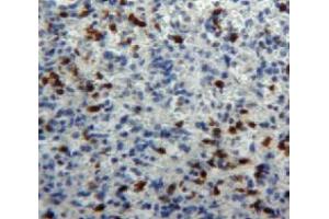 #VALUE! (Myeloperoxidase antibody  (AA 253-718))