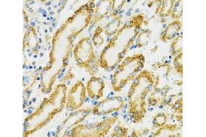 Immunohistochemistry of paraffin-embedded Rat kidney using HSPA9 Polyclonal Antibody at dilution of 1:100 (40x lens). (HSPA9 antibody)