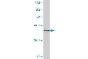 Western Blot detection against Immunogen (38. (MLL/KMT2A antibody  (AA 3561-3670))