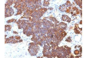 Formalin-fixed, paraffin-embedded human Parathyroid stained with PTH Mouse Monoclonal Antibody (PTH/1173).