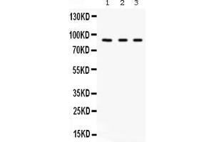 Western blot analysis of Factor B expression in A549 whole cell lysates ( Lane 1), 293T whole cell lysates ( Lane 2) and HELA whole cell lysates ( Lane 3). (Complement Factor B antibody  (AA 518-764))
