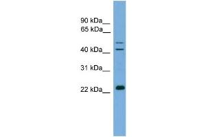 WB Suggested Anti-CHP  Antibody Titration: 0. (CHP antibody  (N-Term))