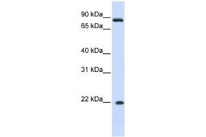 IFN Alpha 7 antibody used at 1 ug/ml to detect target protein. (IFNA7 antibody  (N-Term))