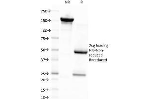 SDS-PAGE Analysis Purified EBV Mouse Monoclonal Antibody (CS4). (EBV LMP1 antibody)