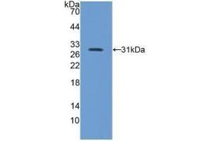Detection of Recombinant ITGb5, Mouse using Polyclonal Antibody to Integrin Beta 5 (ITGb5) (Integrin beta 5 antibody  (AA 136-378))