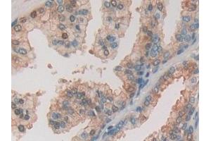 Detection of gSAP in Human Prostate Tissue using Polyclonal Antibody to Gamma-Secretase Activating Protein (gSAP)