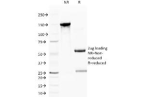 SDS-PAGE Analysis Purified CD59 Mouse Monoclonal Antibody (BRA-10G). (CD59 antibody)