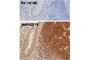 Immunohistochemistry (IHC) image for anti-CD19 Molecule (CD19) (C-Term) antibody (ABIN6254219) (CD19 antibody  (C-Term))