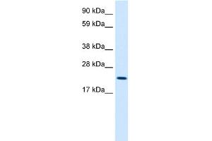 WB Suggested Anti-MYCL1 Antibody Titration:  2. (LMYC antibody  (Middle Region))
