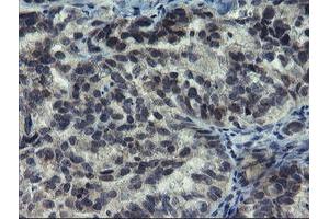 Image no. 1 for anti-Negative Regulator of Ubiquitin-Like Proteins 1 (NUB1) (AA 1-326) antibody (ABIN1490744) (NUB1 antibody  (AA 1-326))